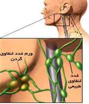 لنفانوپاتی چیست