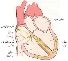 آریتمی قلب