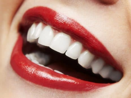 مواد سفیدکننده دندان